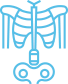 skeletal abnormalities