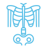 skeletal abnormalities